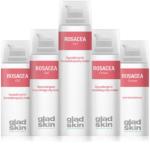 FREE Rosacea Skin Cream - Gratisfaction UK